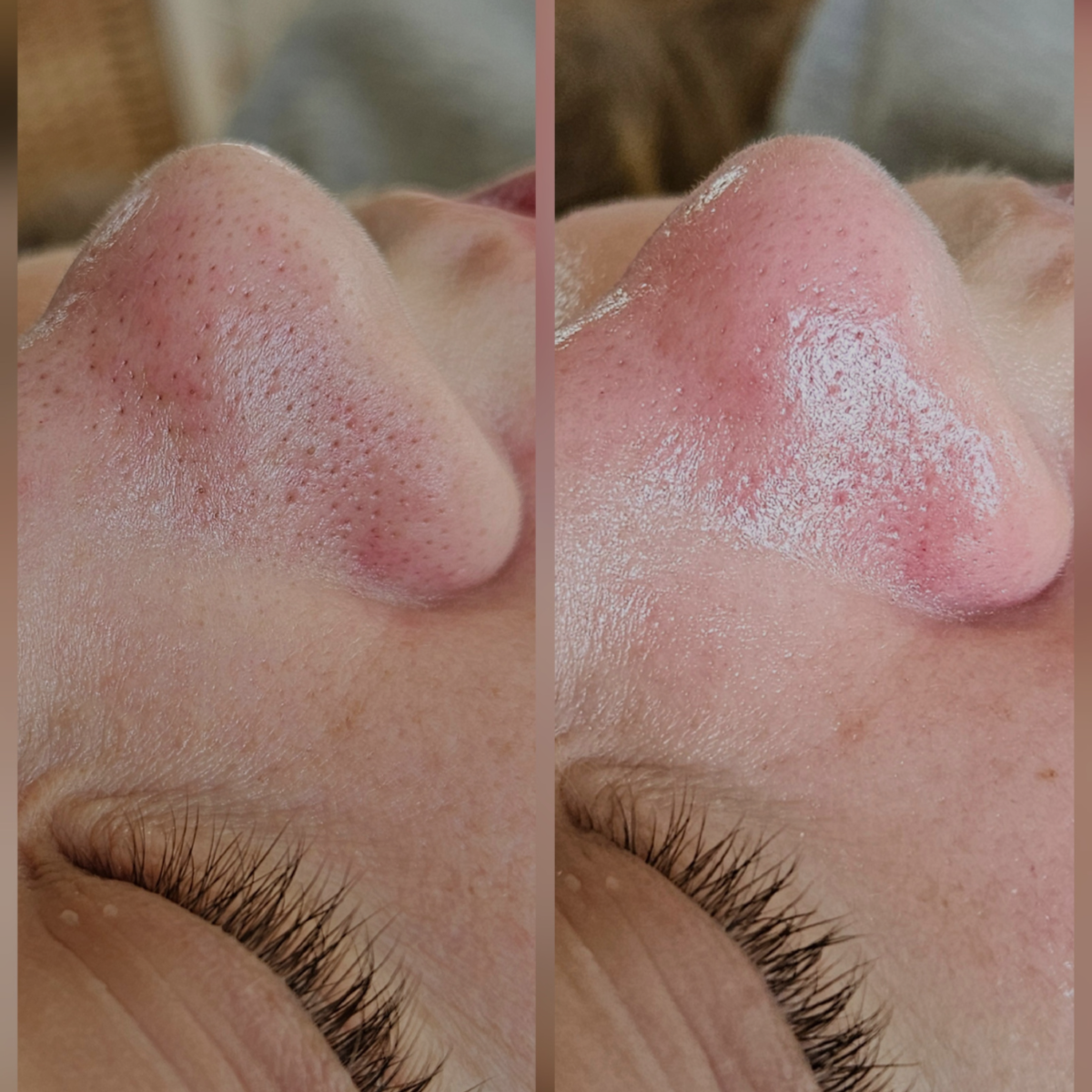 Deep Pore Cleansing Facial