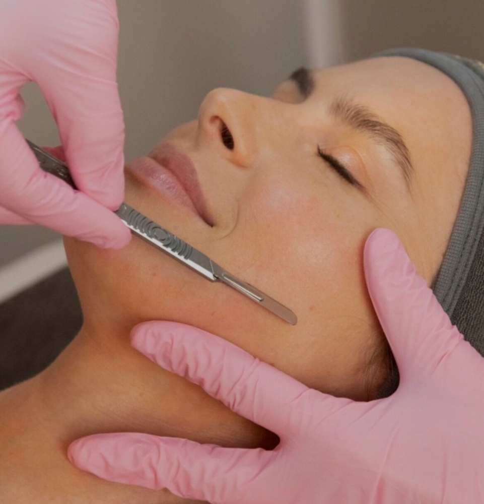 Dermaplaning
