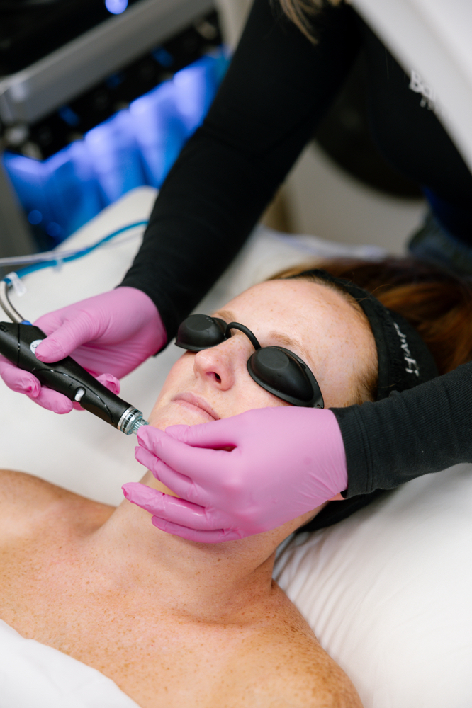 BSE Platinum Hydrafacial at Bare Skin Esthetics in Leawood, KS