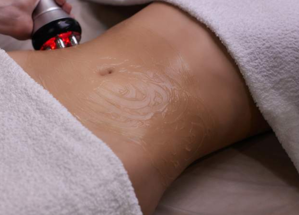 Body Skin Tightening W/RF