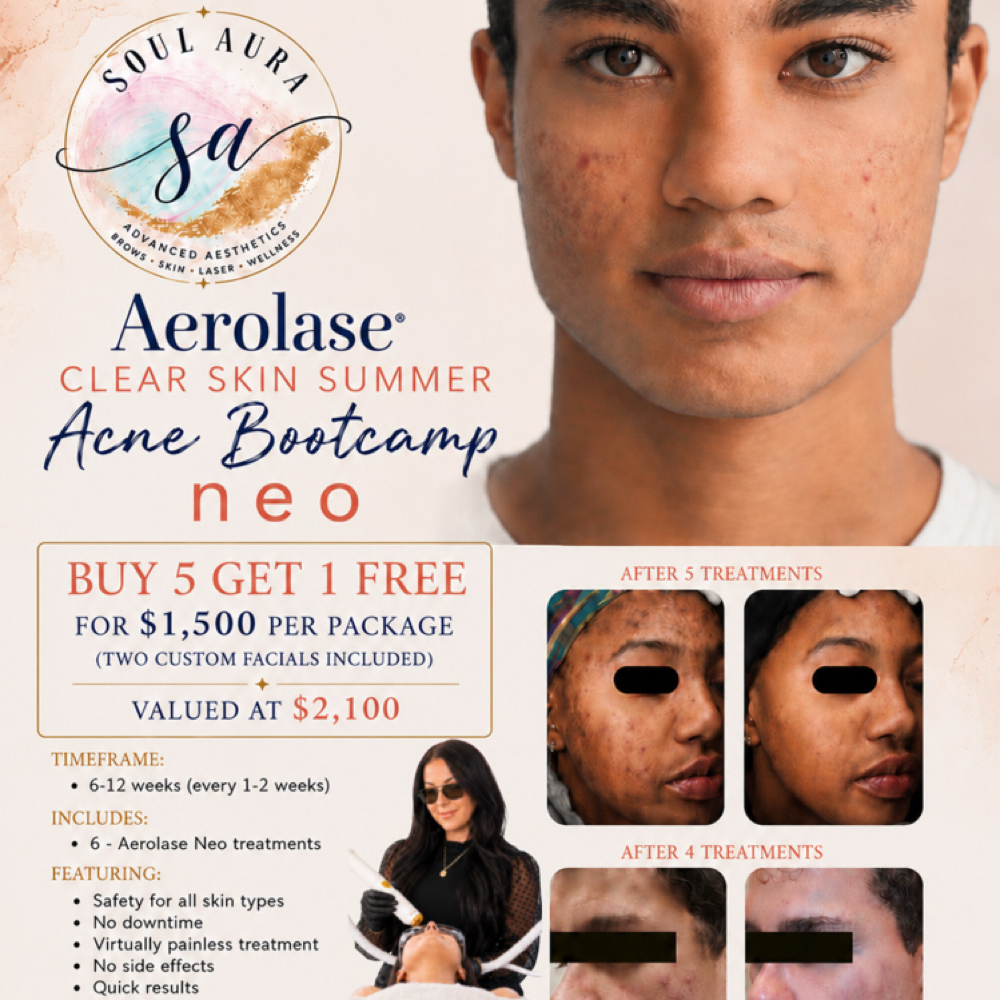 Aerolase neo Laser at Soul Aura in Indian Orchard, MA