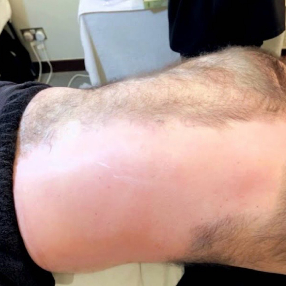 Full Back Wax at Coastal Beauty Spa in Riverview, FL