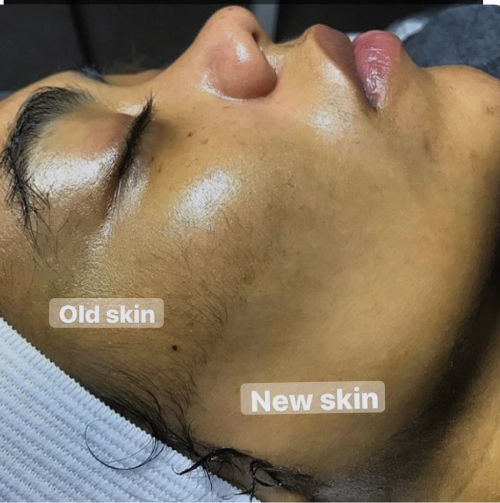 Dermaplane Glow + Double Cleanse at Waxed Culture in Olmos Park, TX