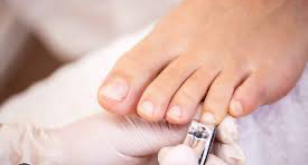 Toe Nail Trim/Polish