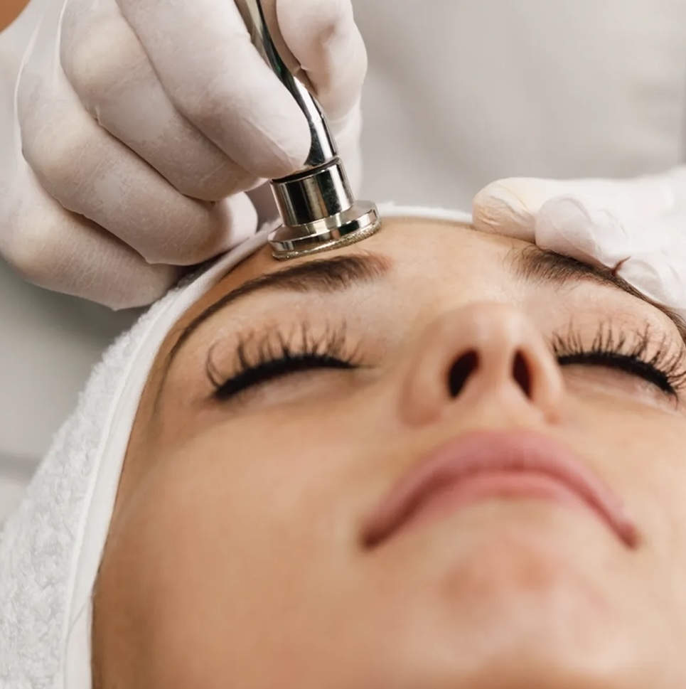 Microdermabrasion