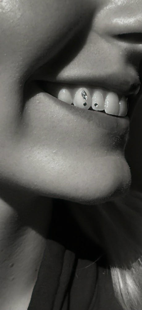 Tooth Gem
