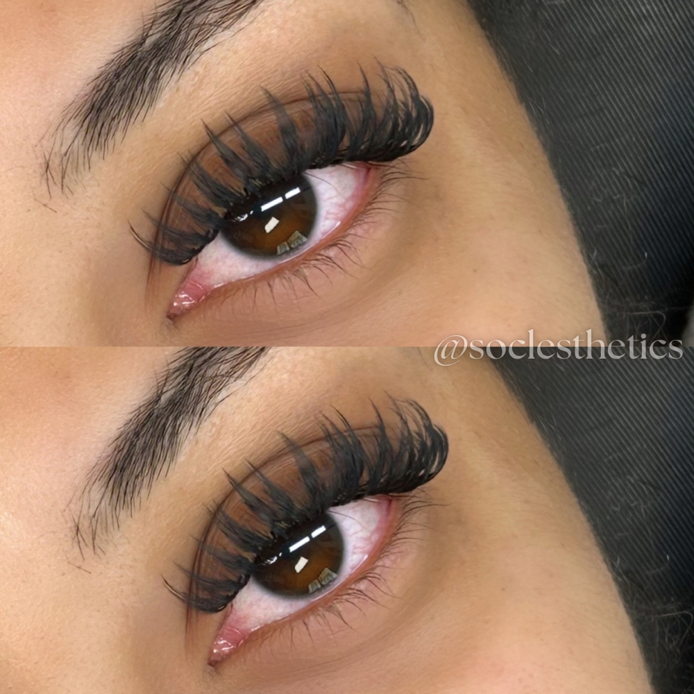 Anime Fluff Fill at SOCL Esthetics in Indianapolis, IN