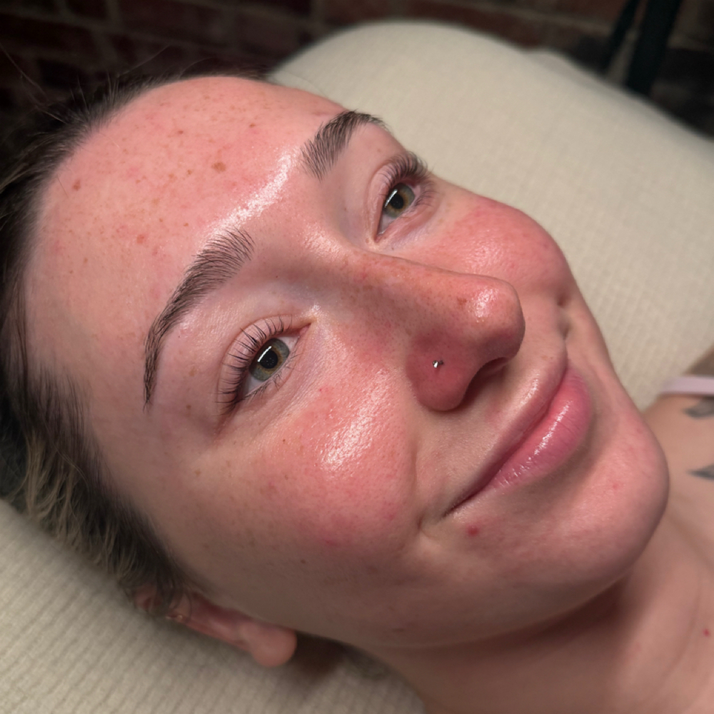 ADD ON- Dermaplaning at AgeLessAesthetics in Lake Havasu City, AZ