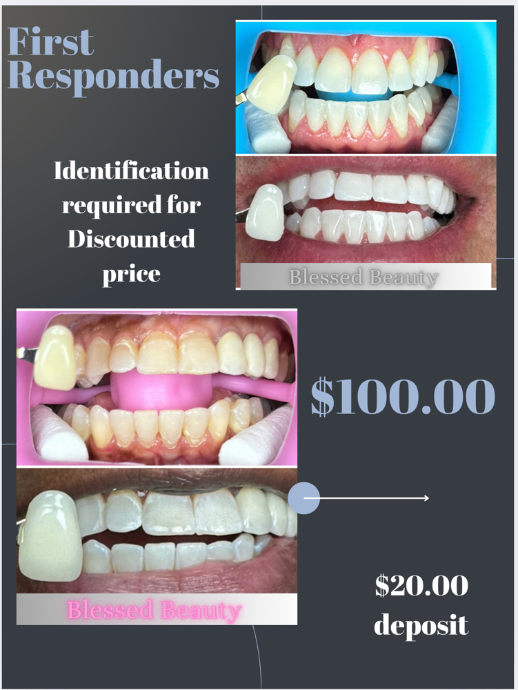 Teeth Whitening/First Responders at Blessed Beauty in El Paso, TX