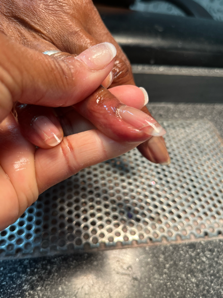 Nail Repair