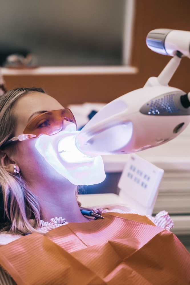 Teeth Whitening