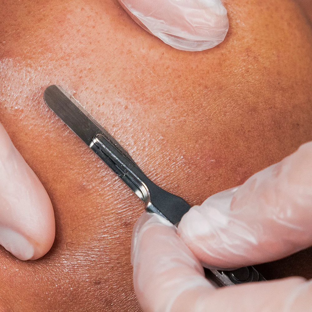 Dermaplaning Add-On at Salt + Light Skincare in Atascocita, TX