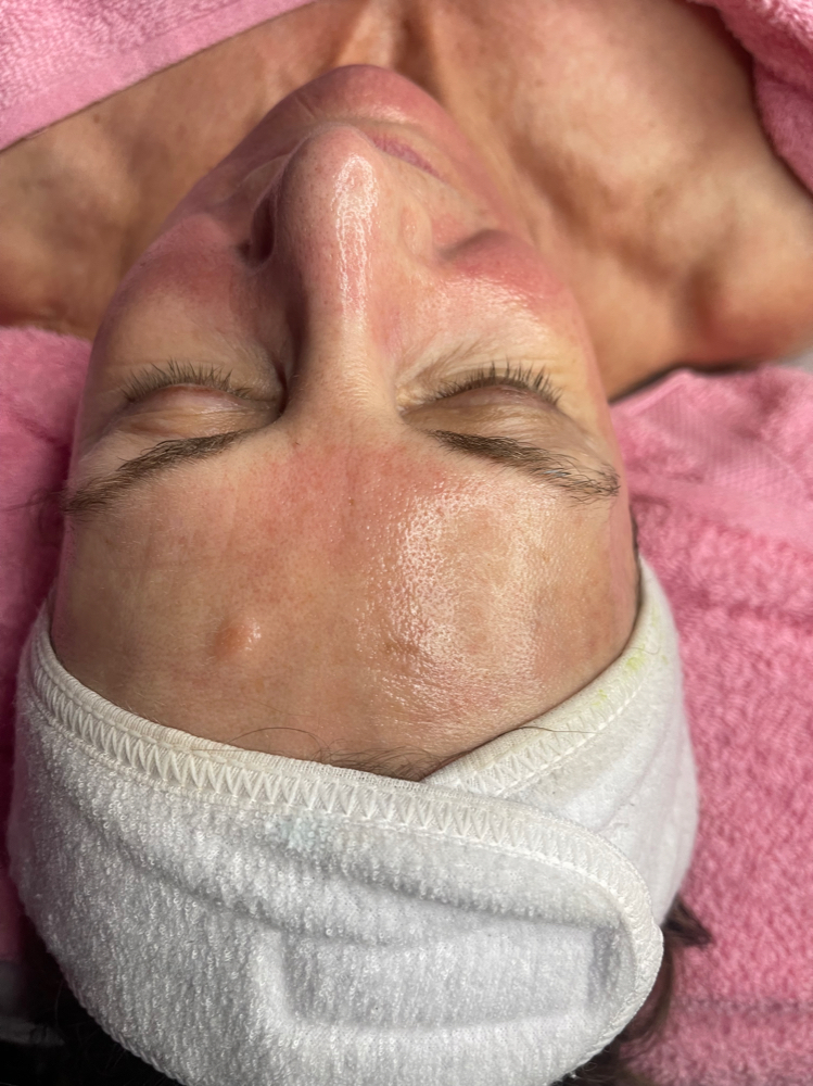 Dermaplane Express Service