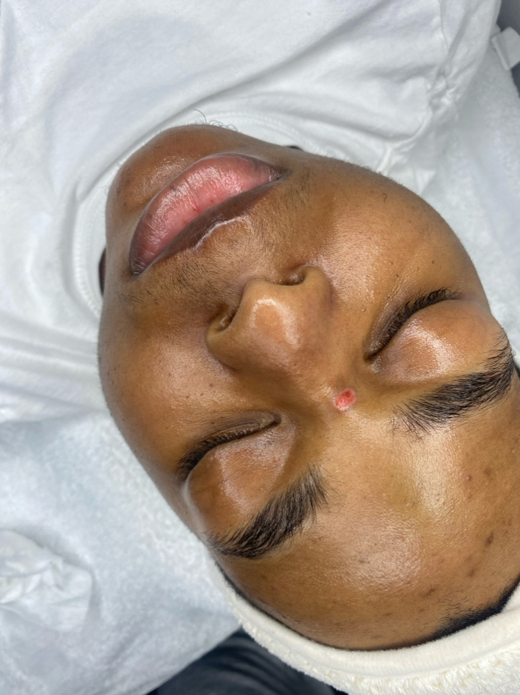 Balance Facial