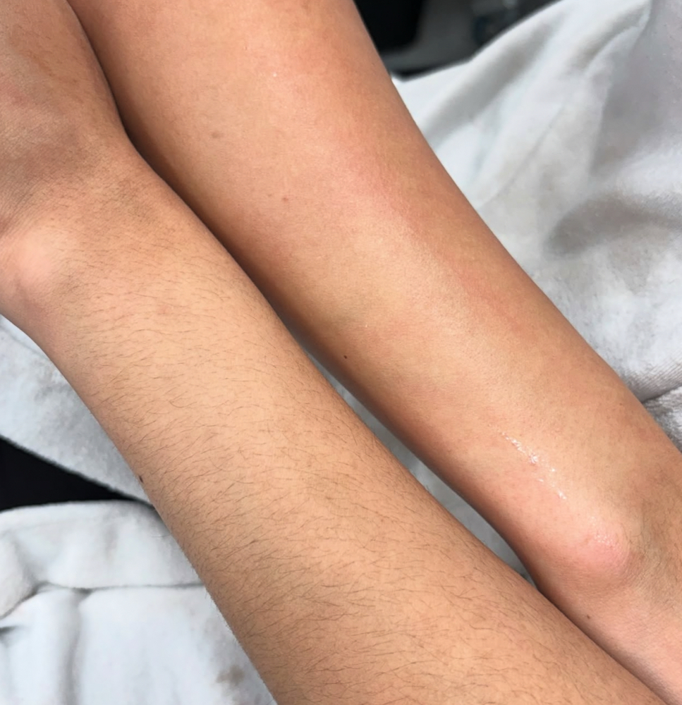 Arms at Peachy polish in Elgin, IL