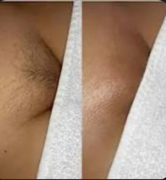 Women’s Full Brazilian Wax