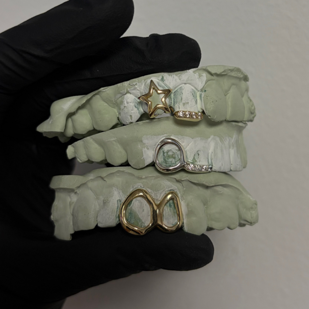 Grillz Pick-Up at Celestial Gemz in Hammond, IN