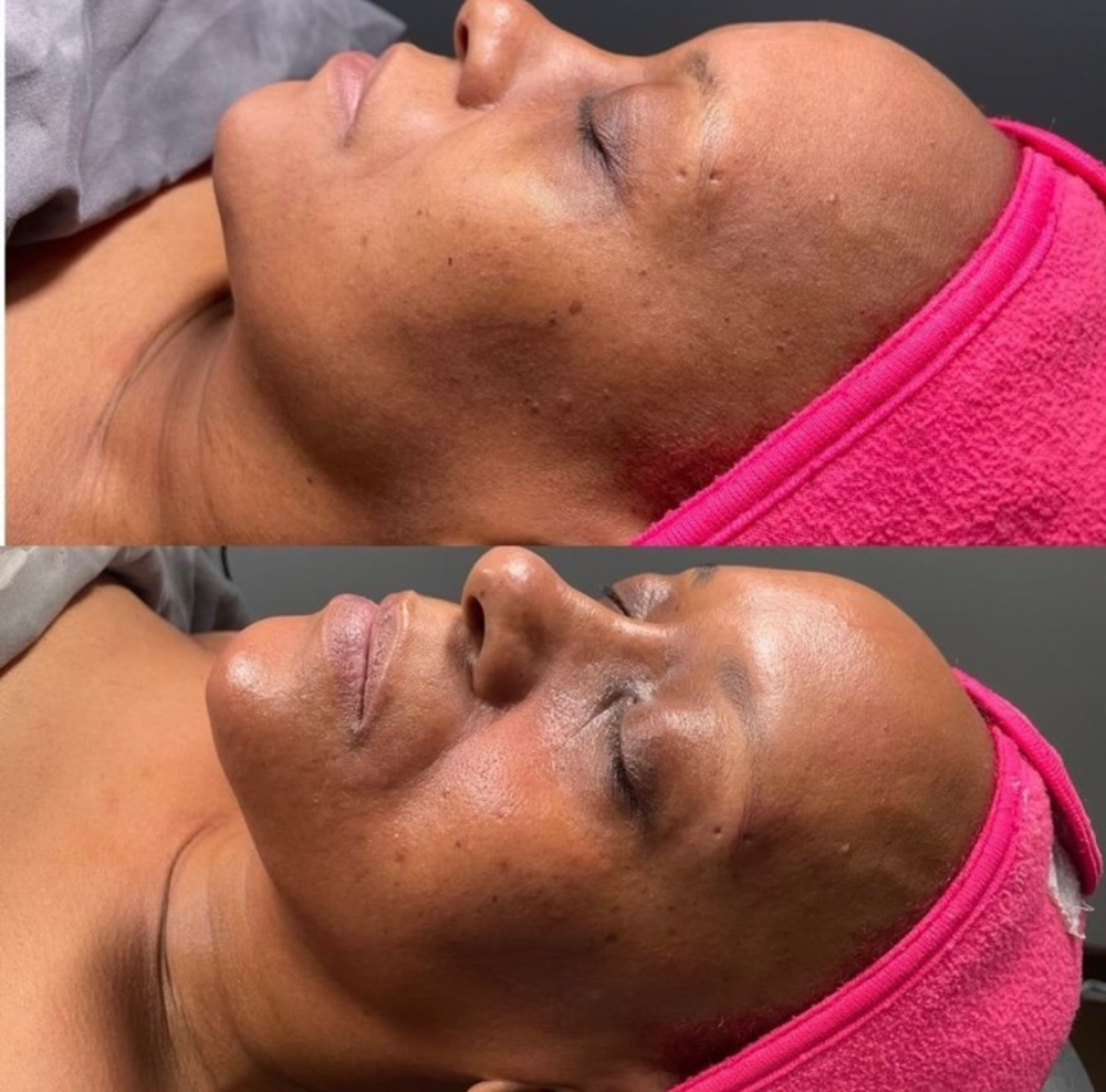 Radiance Cleansing Facial