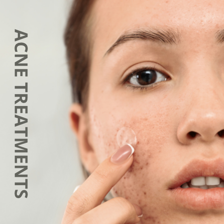 Follow up Clincal Acne Treatment