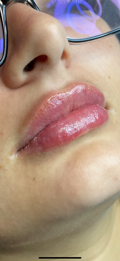 Hyaluron Pen Lip Touch Up (Half ML)