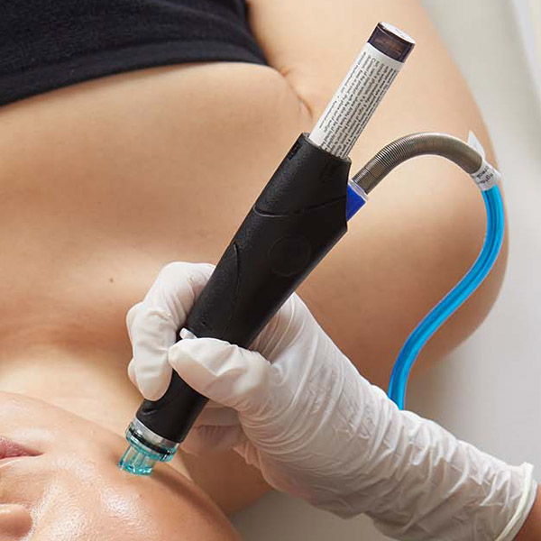 New Client Hydrafacial