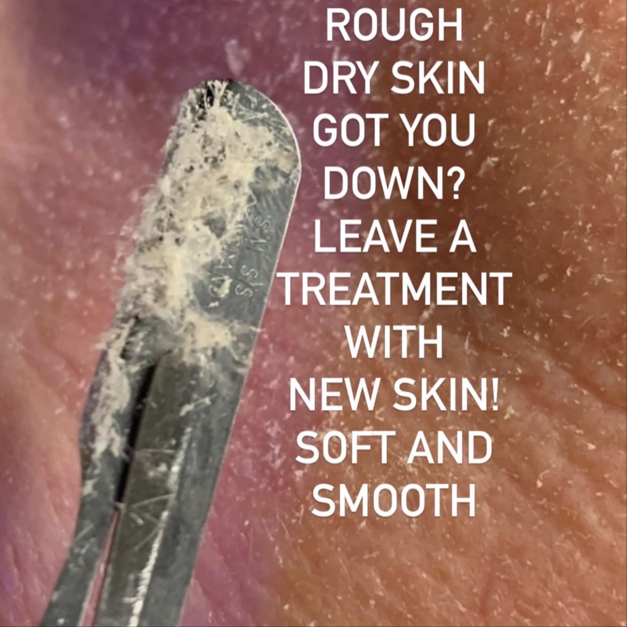 Microderm/Dermaplaning Treatment at Plush Spa in Joplin, MO