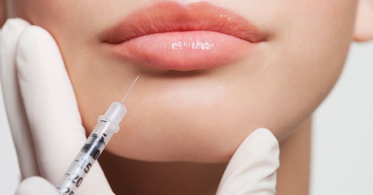 Lips Hyaluronic Filler