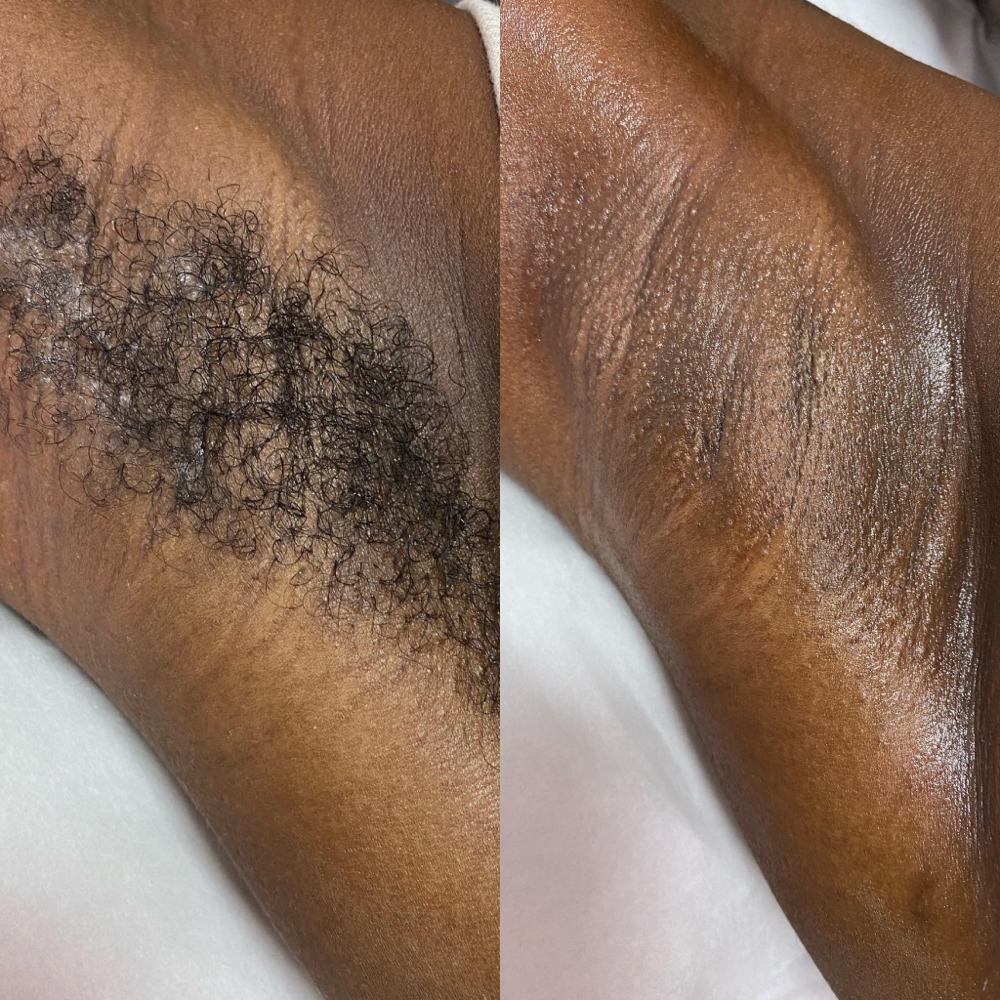 Underarms Wax