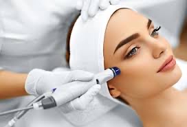 Microdermabrasion