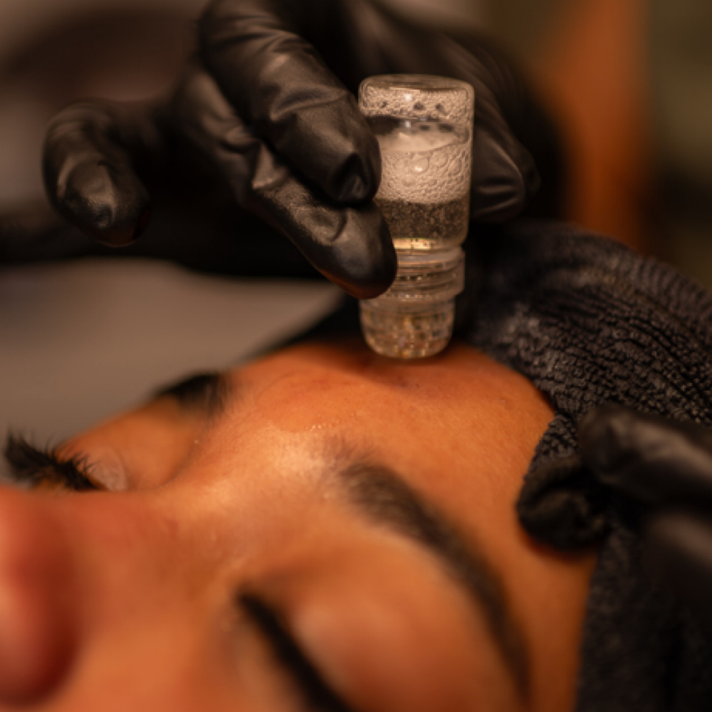 Red Carpet Facial at Esther Esthetics in Suwanee, GA