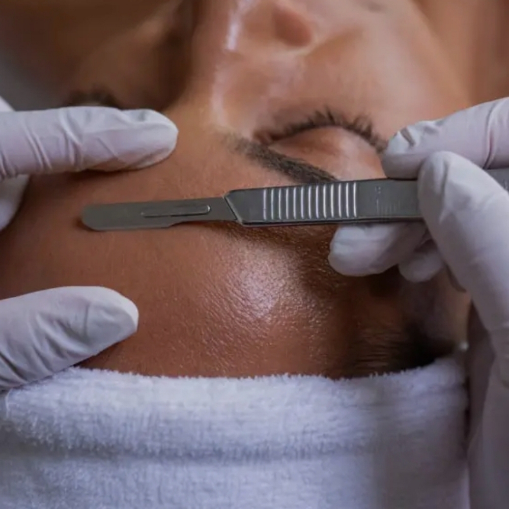 Express Dermaplaning GLOW at let's face it by Ash in Evans, CO