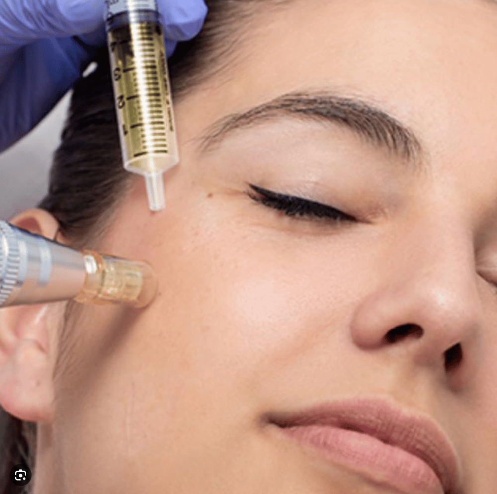 LB Skinbooster+Microneedling