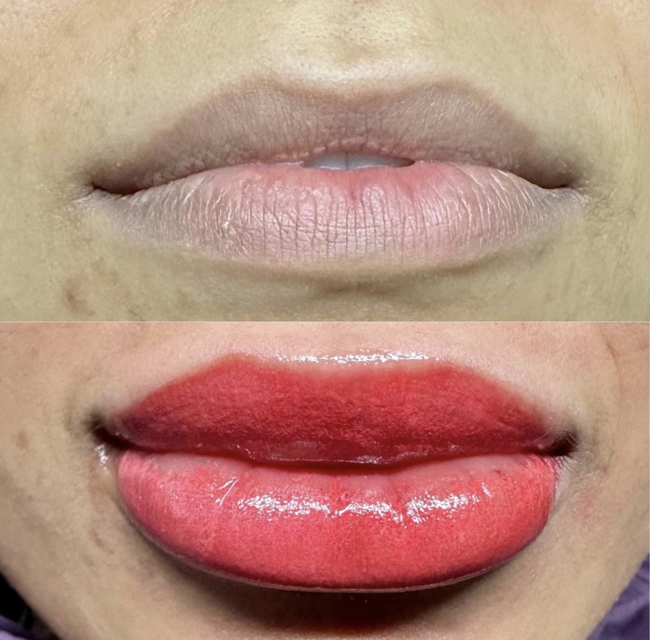 Lip - Dark Lip Neutralization