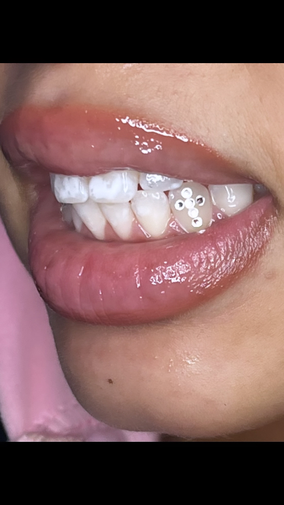 ‘Psalms 46:10’ Tooth Gem Set