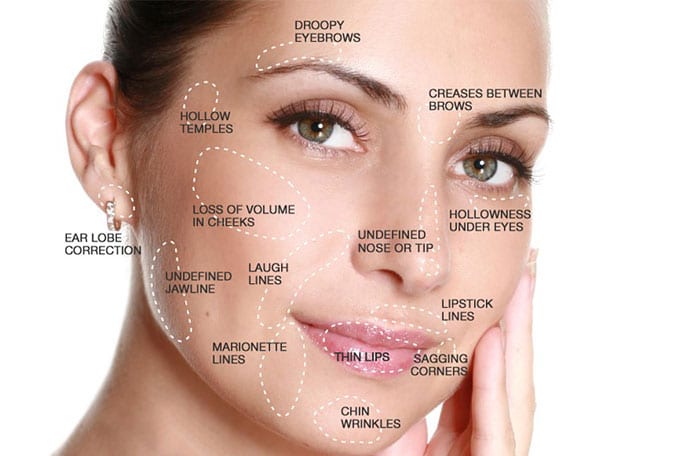 Face Dermal Fillers