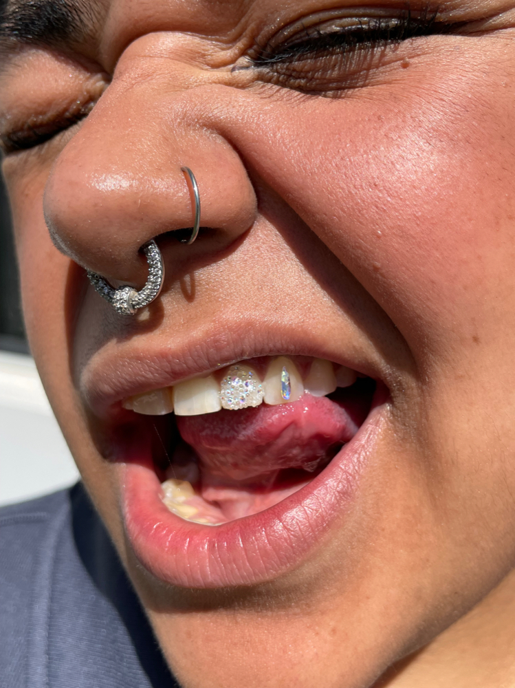 Chandelier Tooth