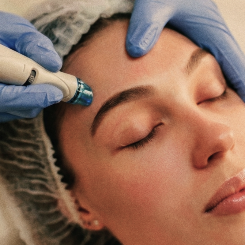HydraFacial at EARTHEN BEAUTY in New York, NY
