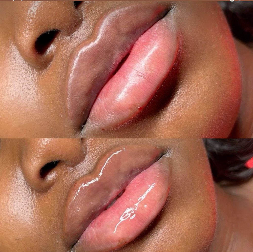 The Signature Plump (1ml)