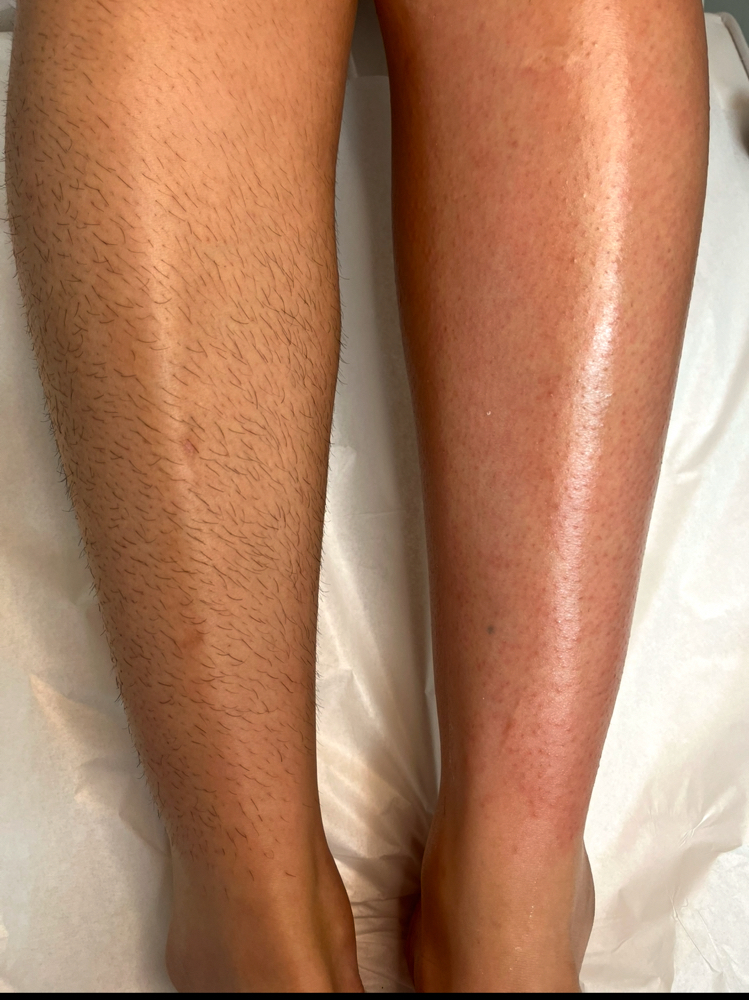 Full Leg