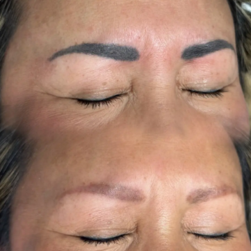 Tattoo Eyebrow Removal at The Beautee Spot in Phoenix, AZ
