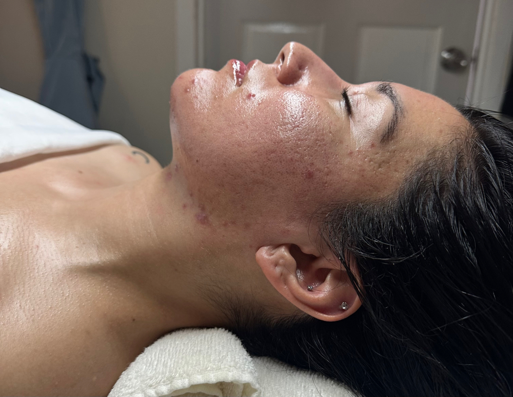 1 Hr. Mana Clear Facial