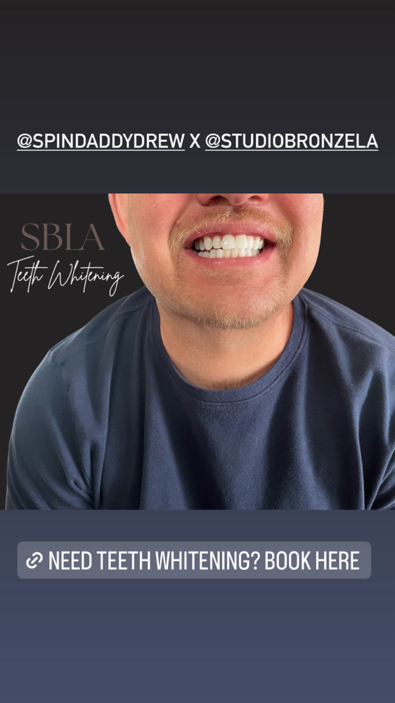 Mobile Teeth Whitening