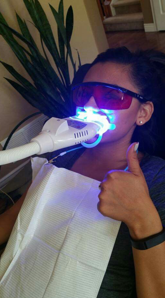 Mobile Teeth Whitening