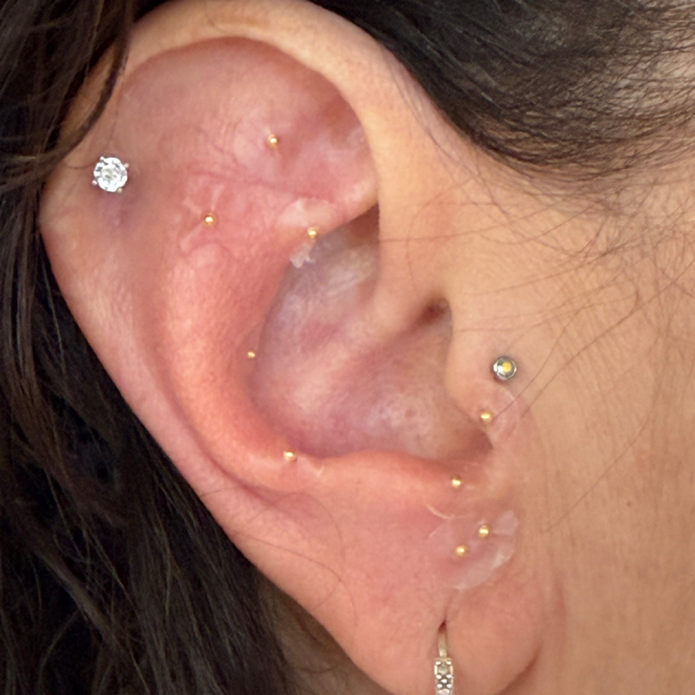 Intuitive Ear seeding at Living Love Letter in Danville, CA