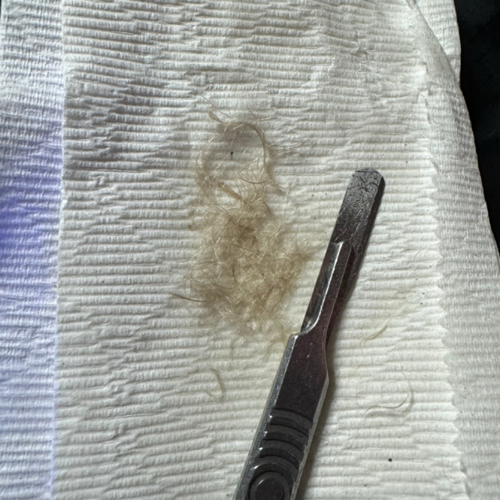 30 Minute Express Dermaplaning at A.L Esthetics in St Clair Shores, MI