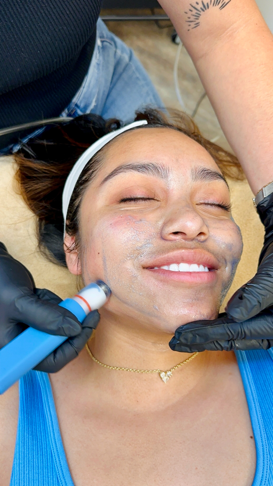 Hydradermabrasion (3 Pack)