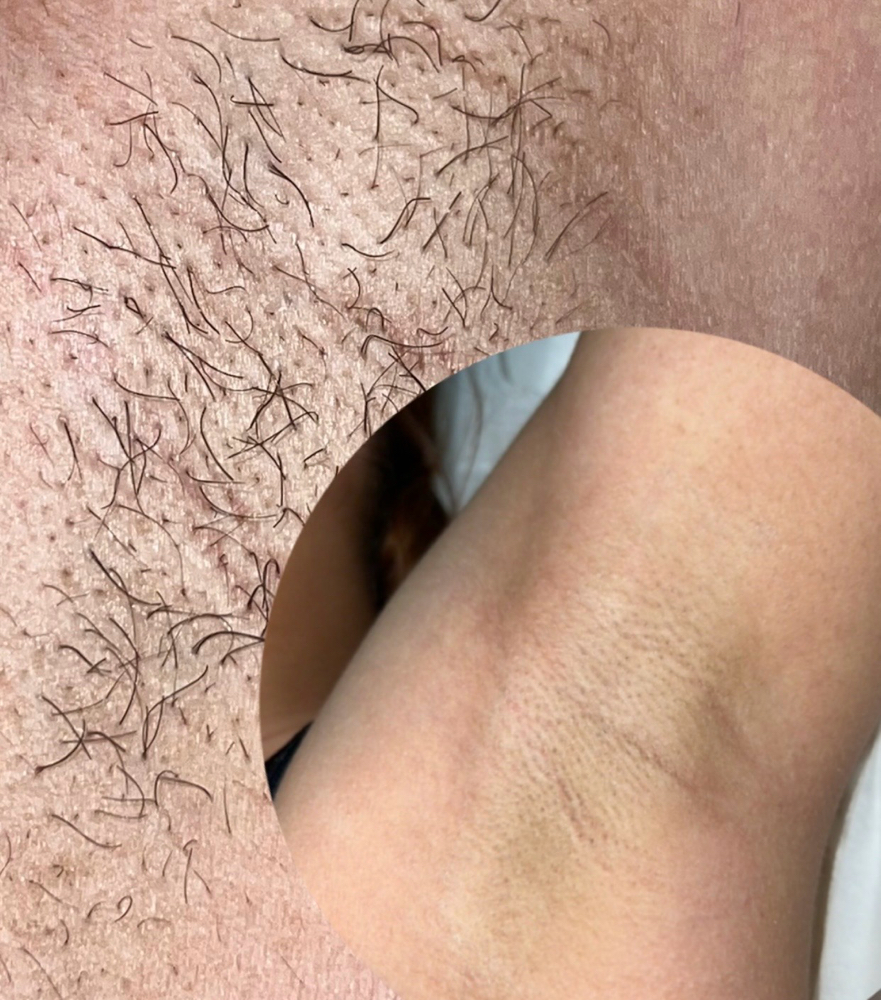 UnderArm Wax