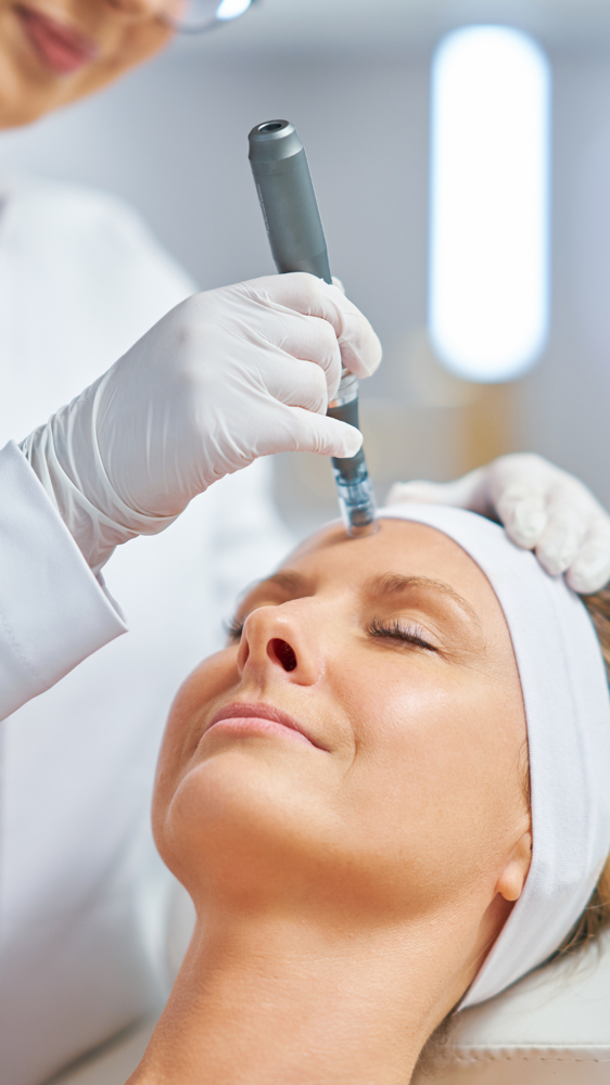 Vampire Forehead Treatment at Dreas Body Sculpting in Napa, CA