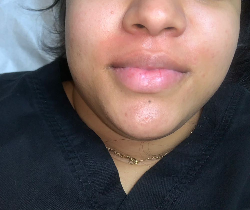 Lip Waxing
