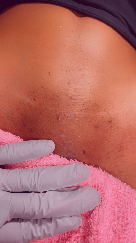 Brazilian Wax